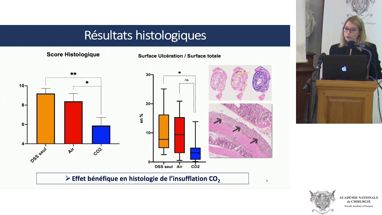 Evaluation de l’effet anti-inflammatoire de l’insufflation intrapéritonéale